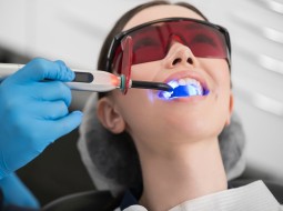Вредно ли отбеливание зубов лазером?