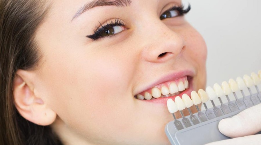 Как быстро отбелить зубы в домашних условиях?